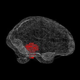 fMRI brainscan online visualization: Pearson Lab